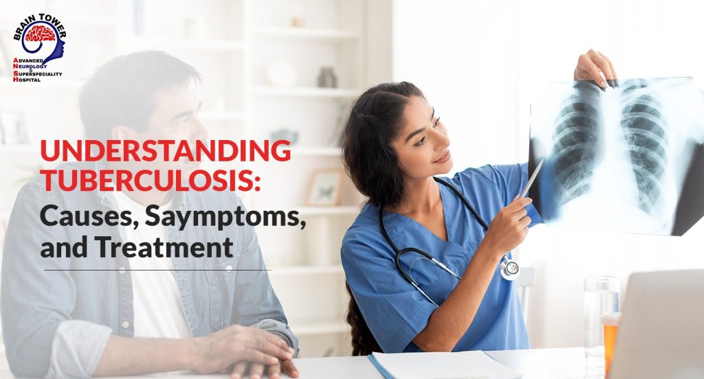 Tuberculosis symptoms